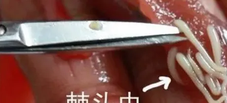 怎么杀死黄鳝体内的寄生虫 | 常识大全