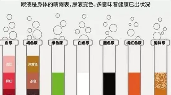 尿液有变化是身体在“报警” | 实用知识