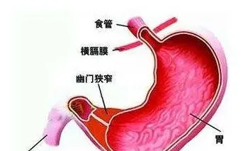 古方治疗胃溃疡 治疗胃溃疡的4个有效偏方 | 常识大全