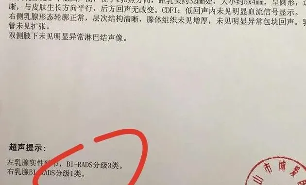 乳腺结节3类怎么治疗最好,乳腺有结节,检查说是3类怎么回事？