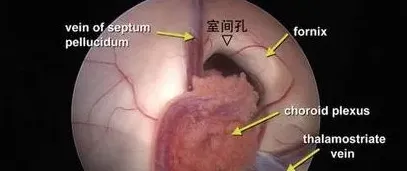 家畜慢性脑室积水的病因、症状与诊治 | 三农知识