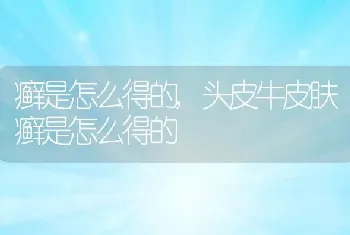 癣是怎么得的,头皮牛皮肤癣是怎么得的